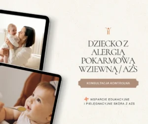 Pojedyncza KONTROLNA konsultacja dla dziecka + Wsparcie edukacyjne i pielęgnacyjne skóra z AZS